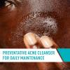 imageCeraVe Acne Treatment Face Wash Salicylic Acid Cleanser with Purifying Clay Niacinamide and Ceramides Pore Control and Blackhead Remover 8 Ounce8 Fl Oz Pack of 1