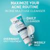 imageCeraVe Clay To Foam Acne Face Wash MultiUse Salicylic Acid ampamp Kaolin Clay Acne Spot Treatment Clears Pimples ampamp Blackheads Prevents Breakouts Hydrates ampamp Soothes FragranceFree NonComedogenic 4oz