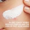 imageCeraVe Clay To Foam Acne Face Wash MultiUse Salicylic Acid ampamp Kaolin Clay Acne Spot Treatment Clears Pimples ampamp Blackheads Prevents Breakouts Hydrates ampamp Soothes FragranceFree NonComedogenic 4oz