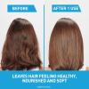 imageCeraVe Hydrating Anti Dandruff Shampoo 1 Pyrithione Zinc Dandruff Treatment With Ceramides Niacinamide ampamp Hyaluronic Acid Helps Eliminate Flakes ampamp Provides Itchy Scalp Relief Sulfate Free 12 Oz12 Fl Oz
